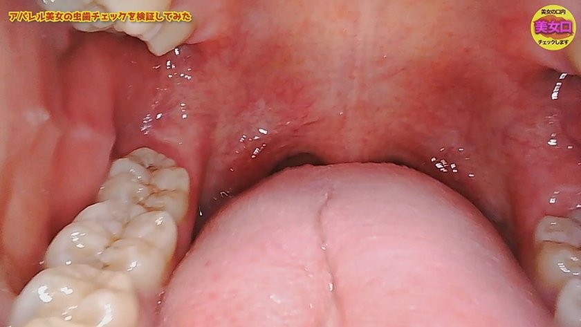 お口の中をじっくり見せてくれませんか？～アパレル店員はるのさん～ 藍瀬ミナ3枚目